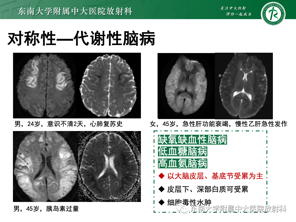 影像PPT - 【PPT】成人常见脑白质病变影像诊断-25