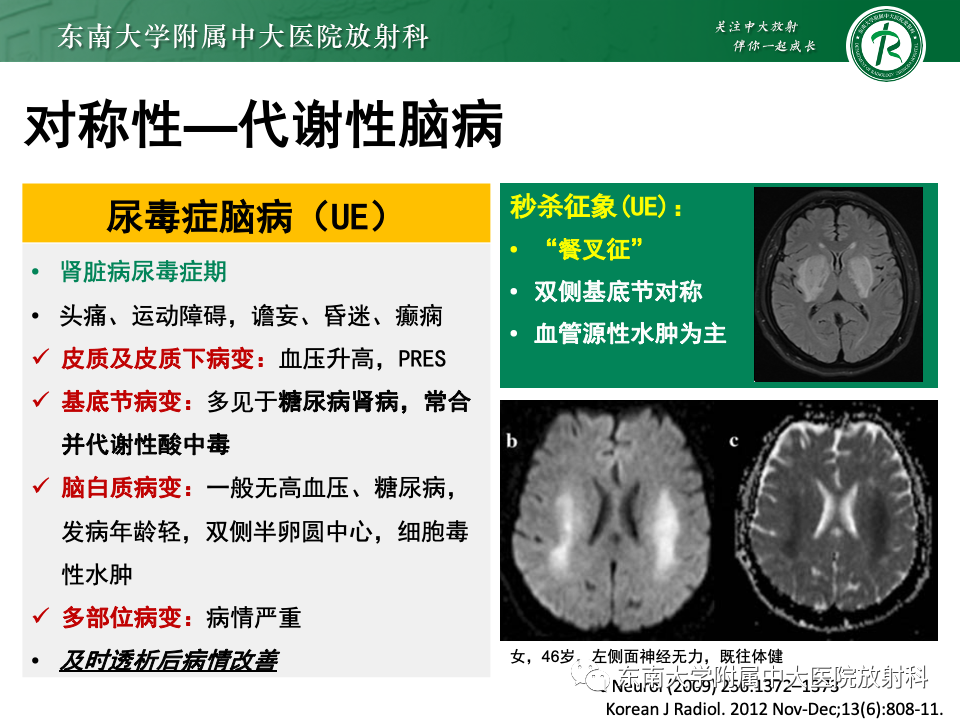 影像PPT - 【PPT】成人常见脑白质病变影像诊断-26