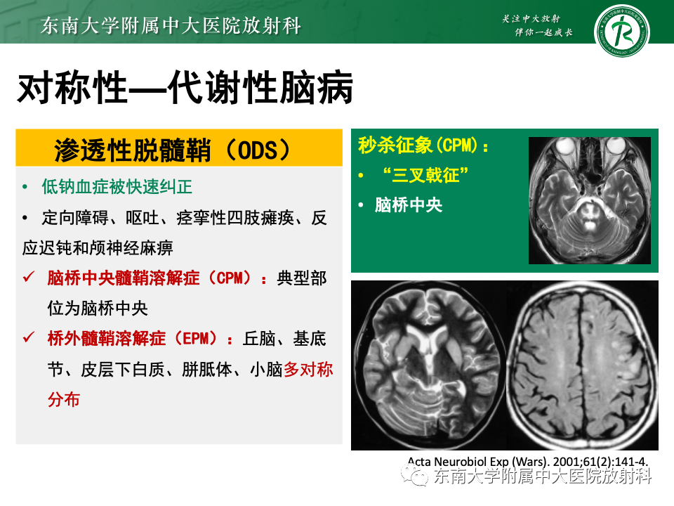 影像PPT - 【PPT】成人常见脑白质病变影像诊断-27