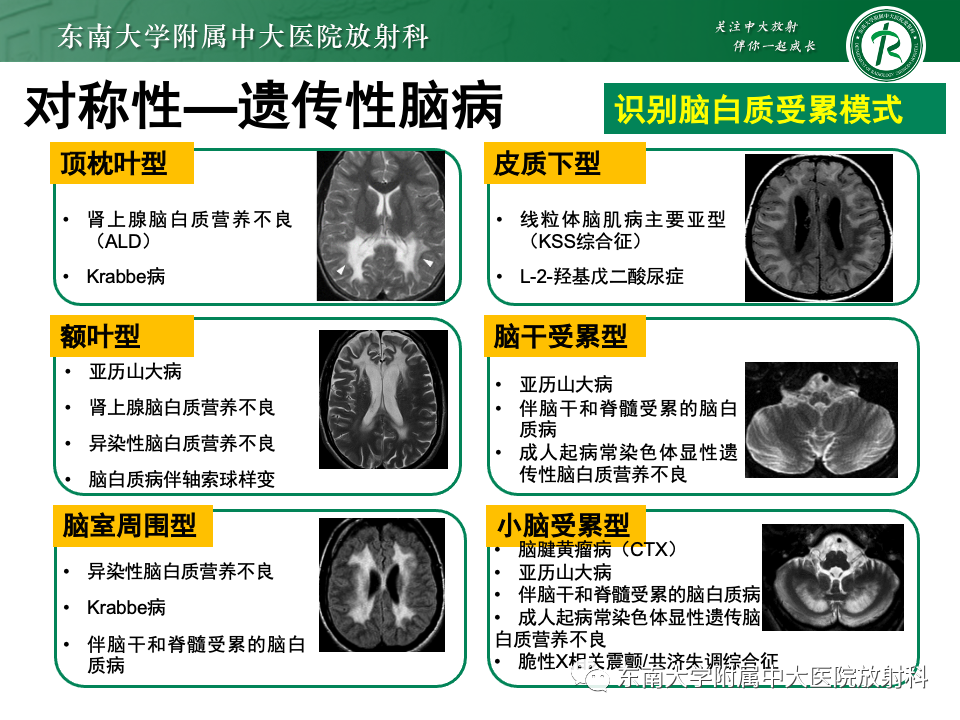 影像PPT - 【PPT】成人常见脑白质病变影像诊断-34