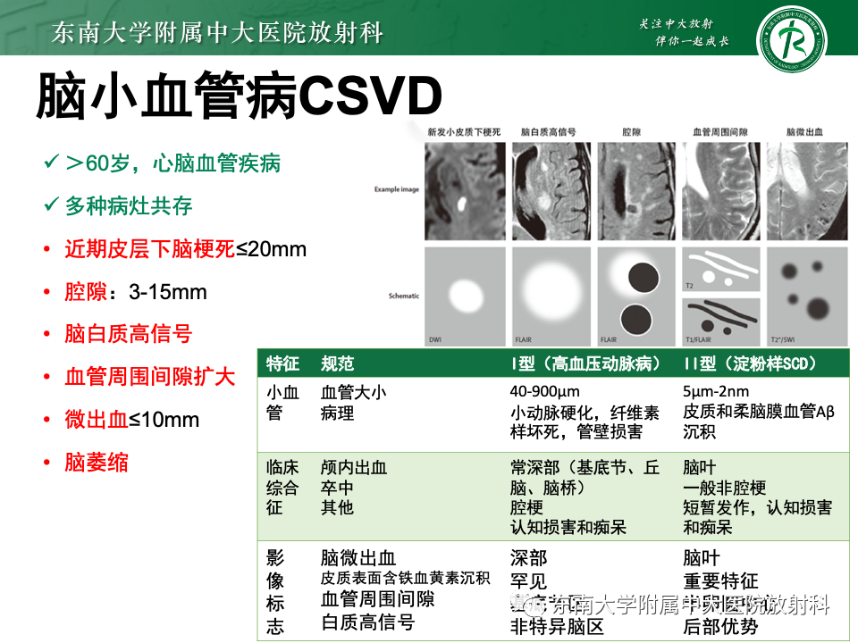 影像PPT - 【PPT】成人常见脑白质病变影像诊断-37