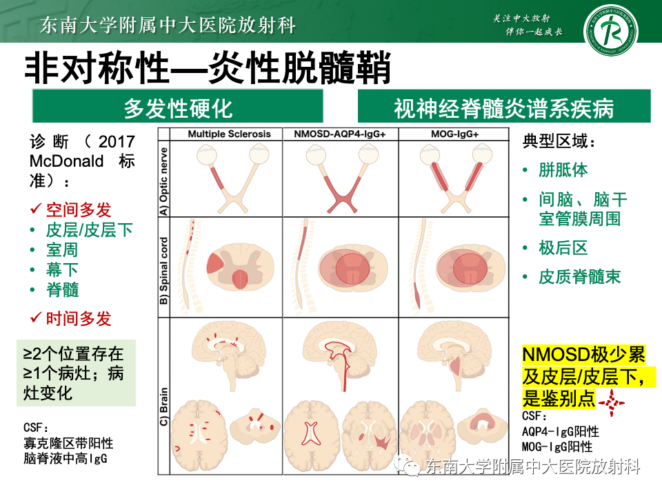 影像PPT - 【PPT】成人常见脑白质病变影像诊断-40