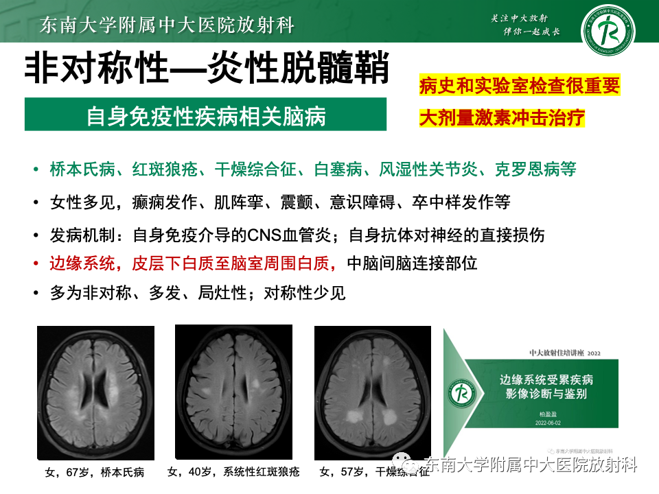 影像PPT - 【PPT】成人常见脑白质病变影像诊断-44