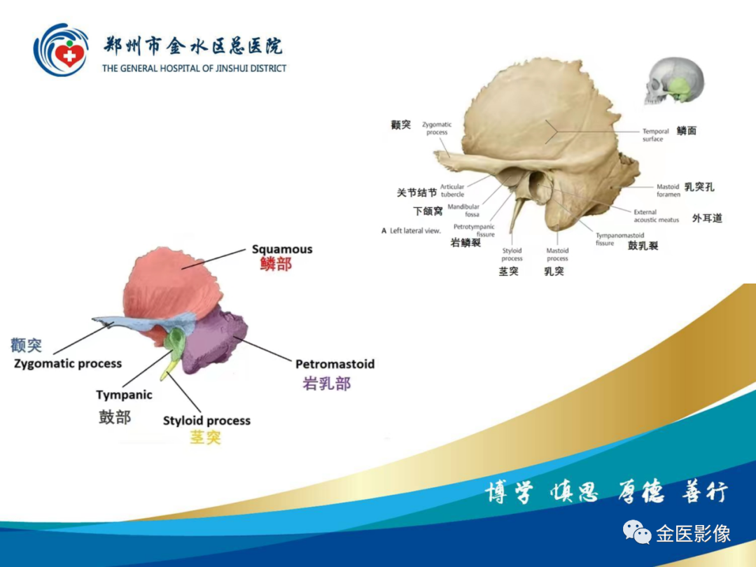 影像PPT - 【PPT】颞骨断层解剖及CT重建-5