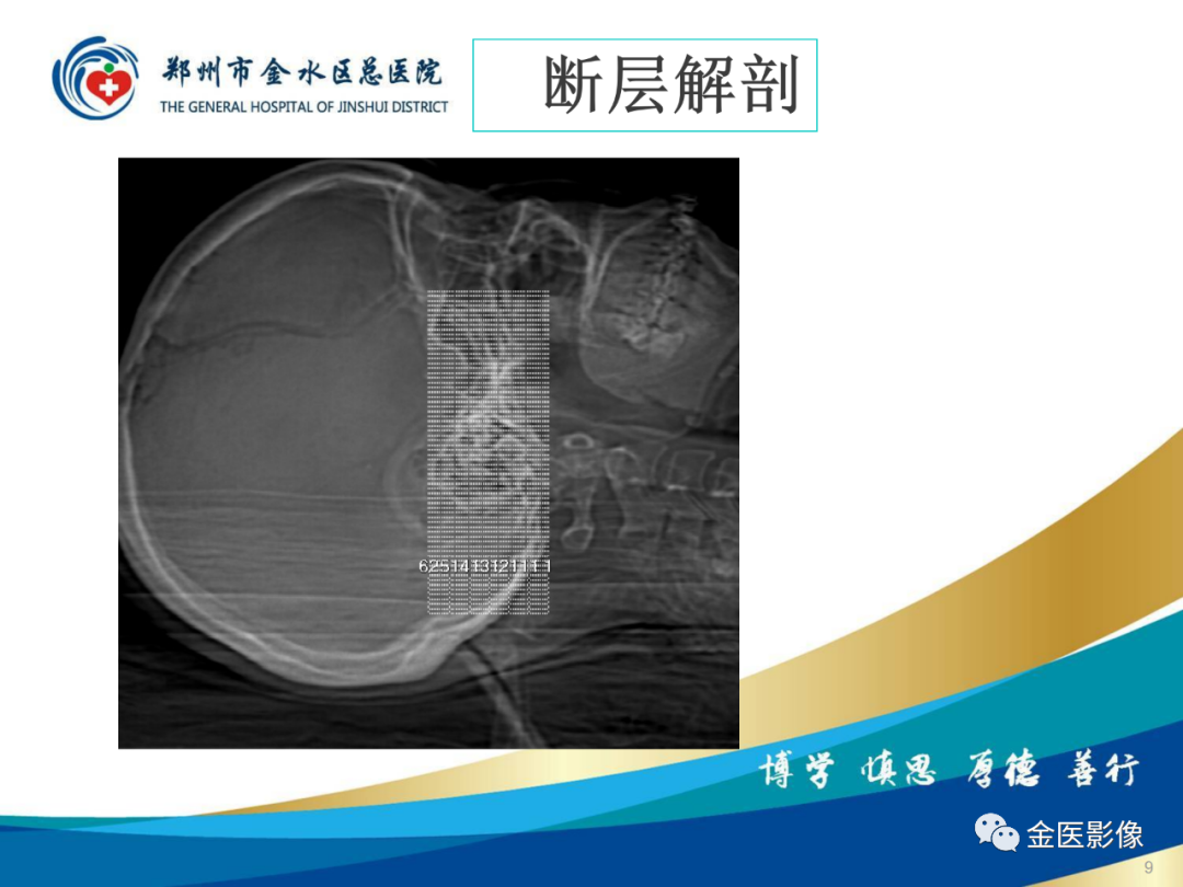 影像PPT - 【PPT】颞骨断层解剖及CT重建-9