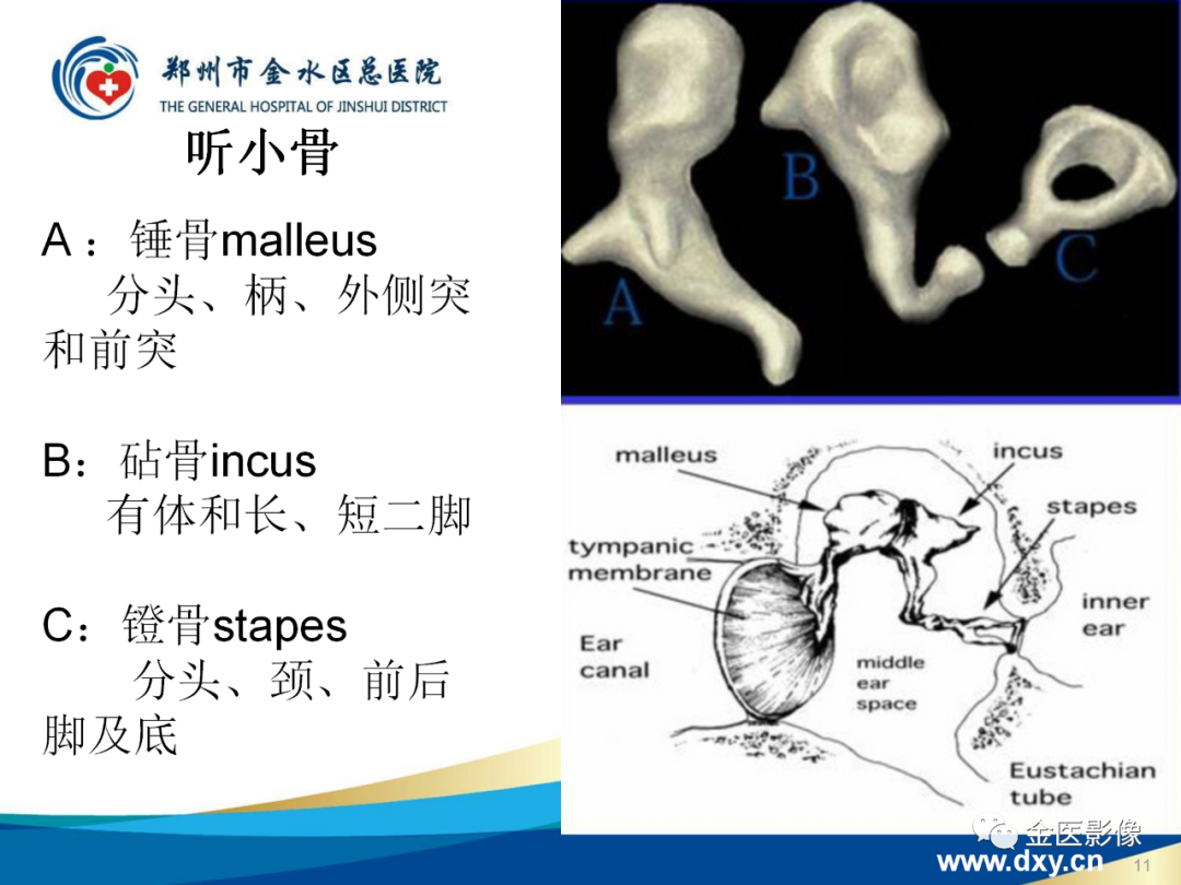 影像PPT - 【PPT】颞骨断层解剖及CT重建-11