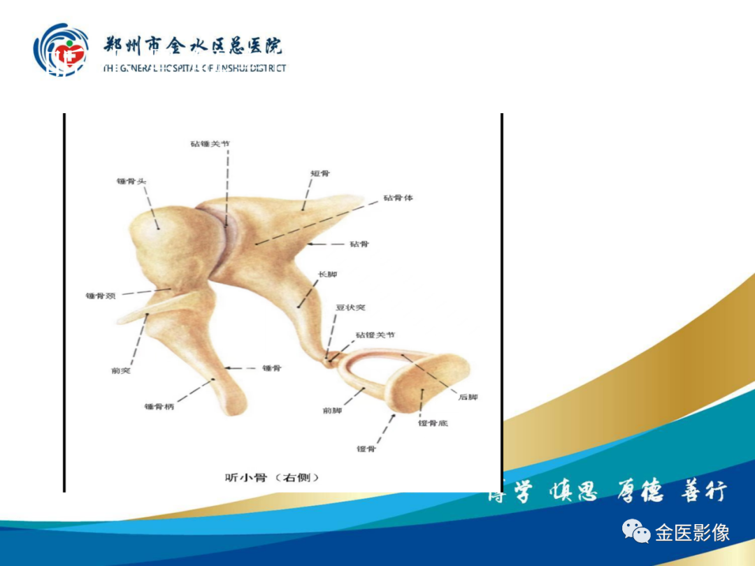 影像PPT - 【PPT】颞骨断层解剖及CT重建-12
