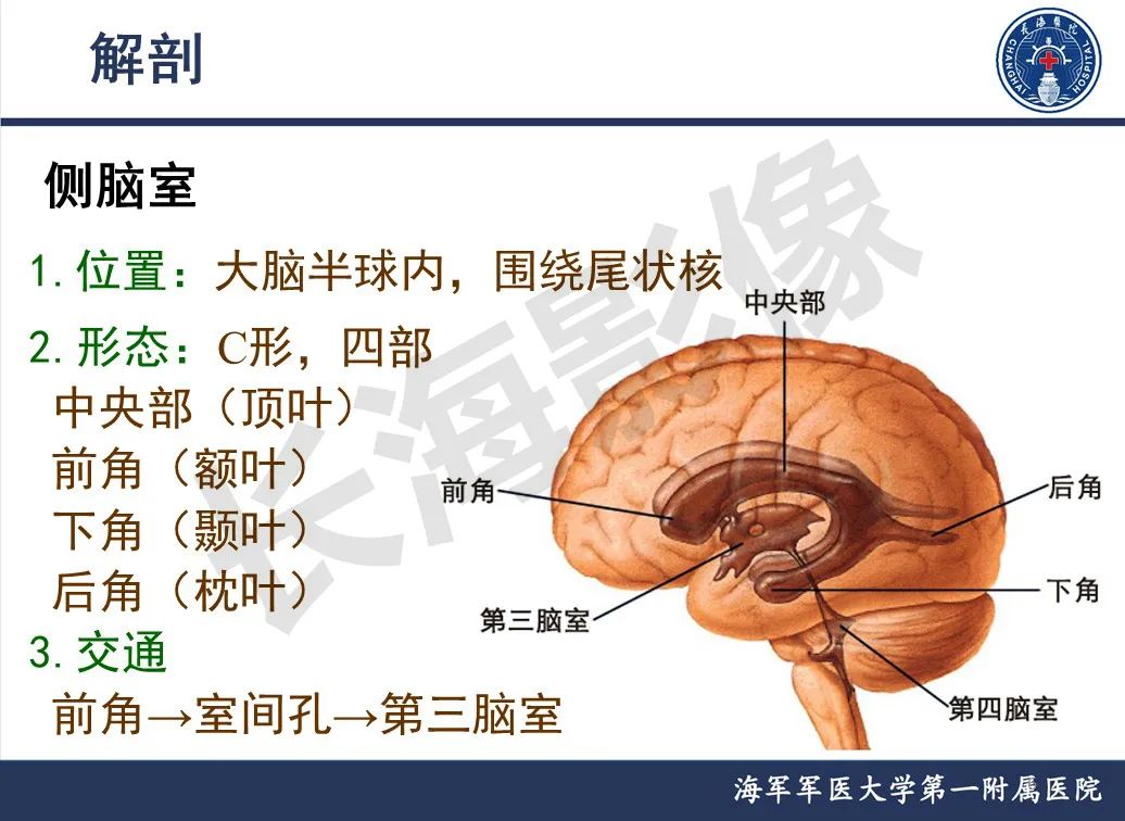 影像PPT - 【PPT】脑室肿瘤-6