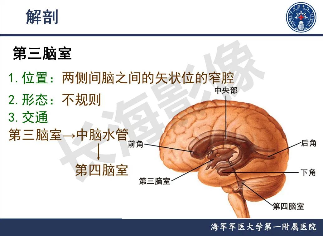 影像PPT - 【PPT】脑室肿瘤-8