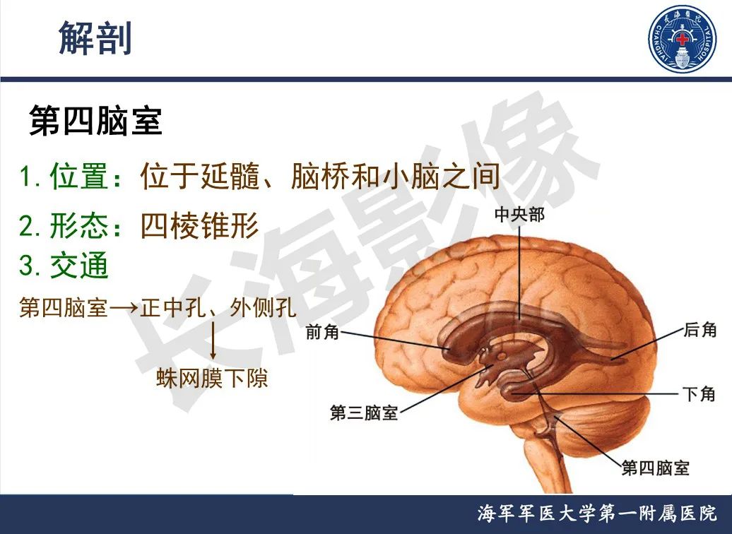 影像PPT - 【PPT】脑室肿瘤-10