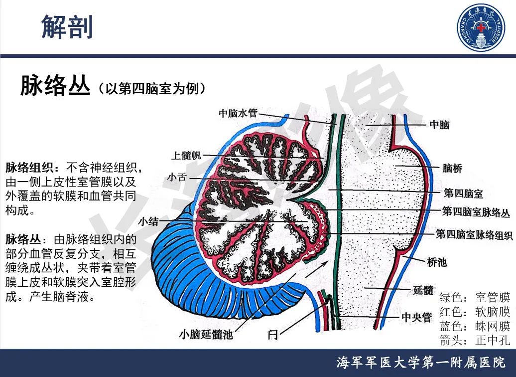 影像PPT - 【PPT】脑室肿瘤-11