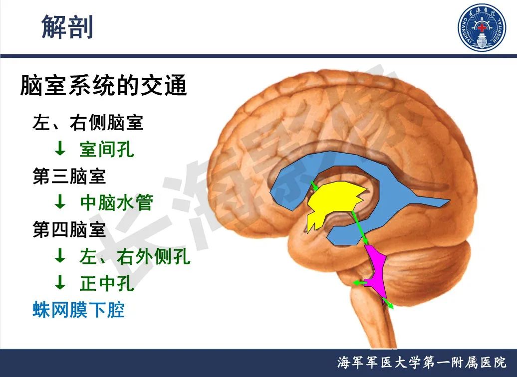 影像PPT - 【PPT】脑室肿瘤-12