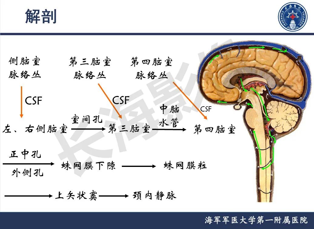 影像PPT - 【PPT】脑室肿瘤-13