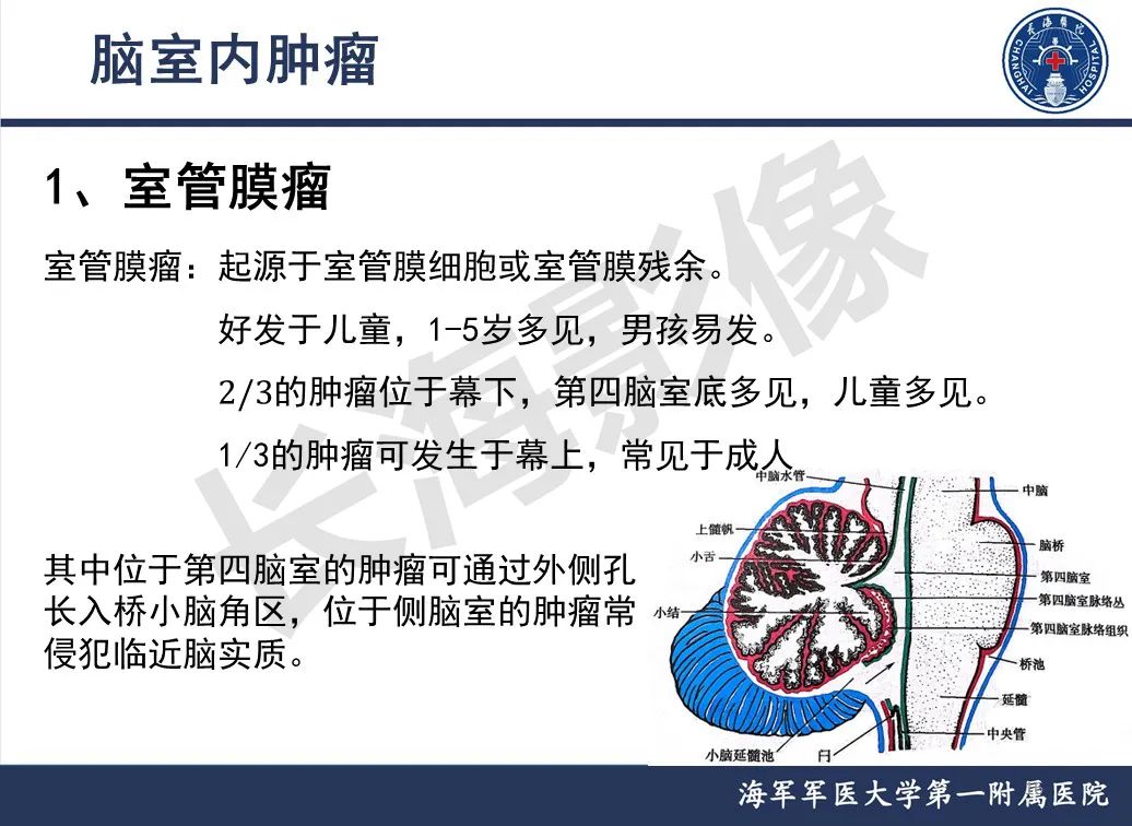 影像PPT - 【PPT】脑室肿瘤-16