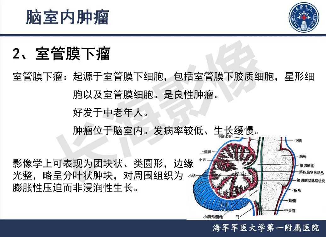 影像PPT - 【PPT】脑室肿瘤-18