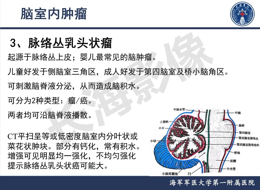 影像PPT - 【PPT】脑室肿瘤-21