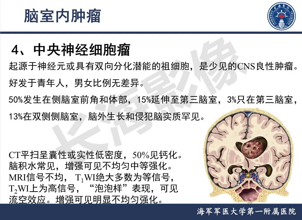 影像PPT - 【PPT】脑室肿瘤-23