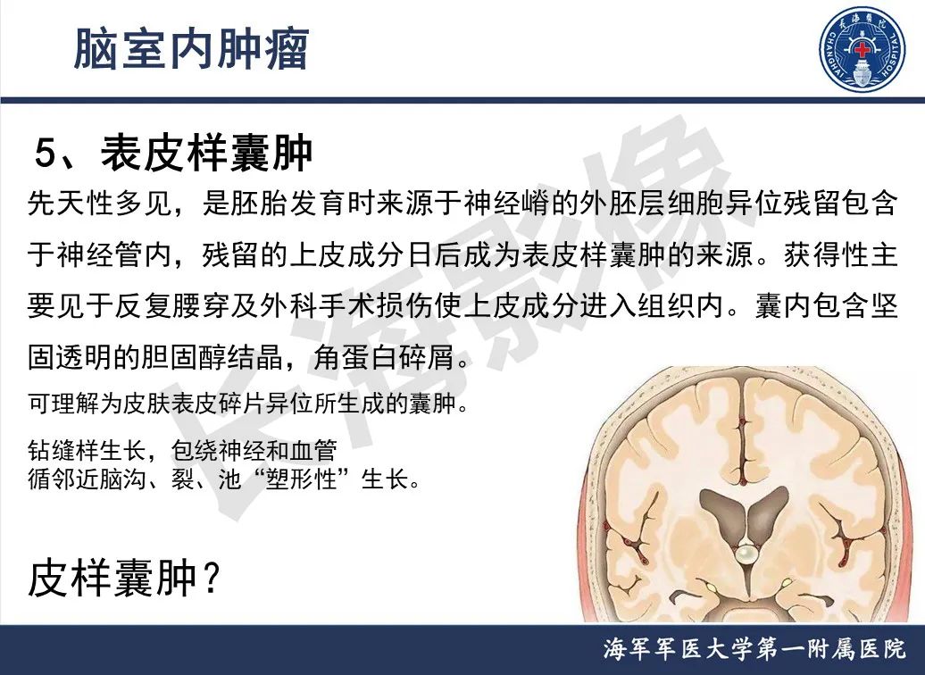 影像PPT - 【PPT】脑室肿瘤-25