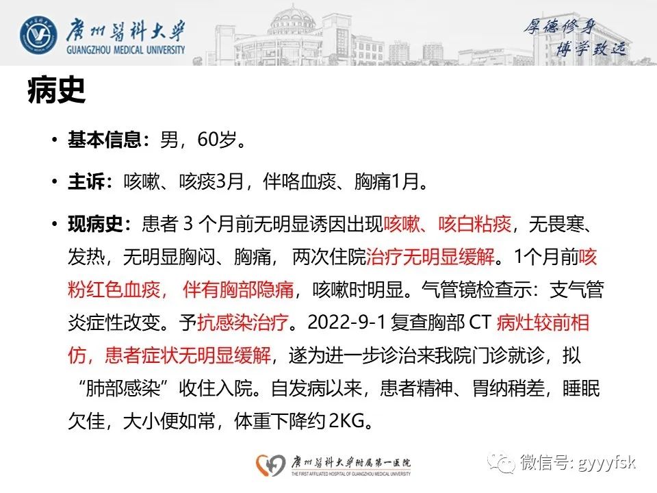 影像PPT - 【PPT】机化性肺炎-2