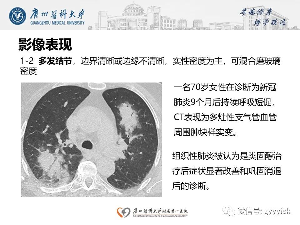 影像PPT - 【PPT】机化性肺炎-17