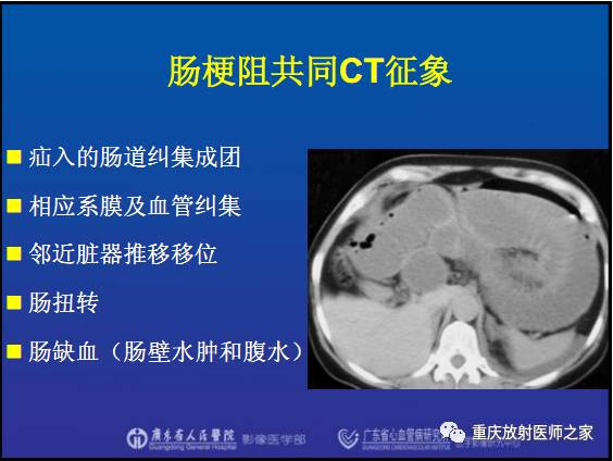 影像PPT - 【PPT】网膜囊疝的影像诊断-5