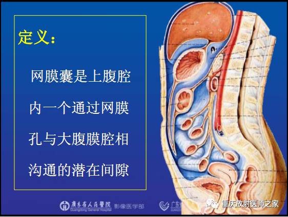 影像PPT - 【PPT】网膜囊疝的影像诊断-8