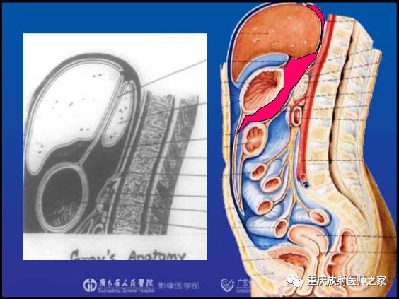 影像PPT - 【PPT】网膜囊疝的影像诊断-9