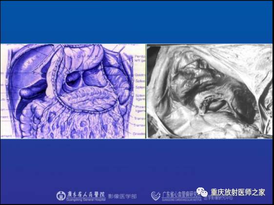 影像PPT - 【PPT】网膜囊疝的影像诊断-10