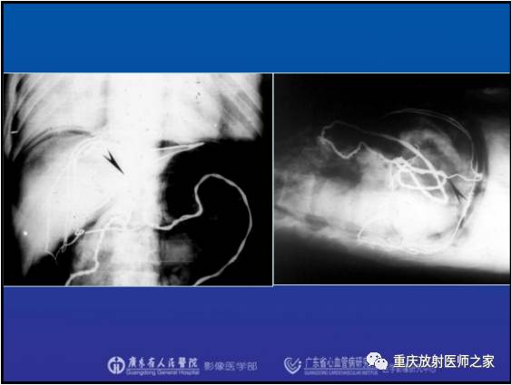 影像PPT - 【PPT】网膜囊疝的影像诊断-11