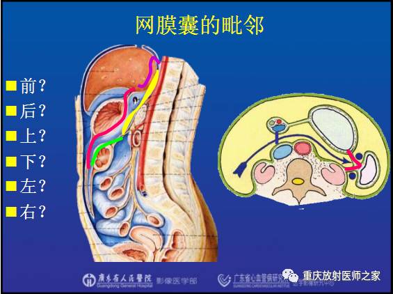 影像PPT - 【PPT】网膜囊疝的影像诊断-13