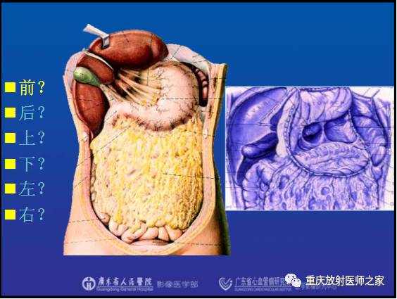 影像PPT - 【PPT】网膜囊疝的影像诊断-14