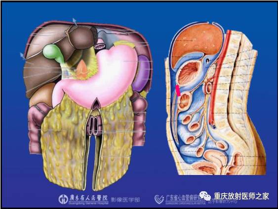 影像PPT - 【PPT】网膜囊疝的影像诊断-15