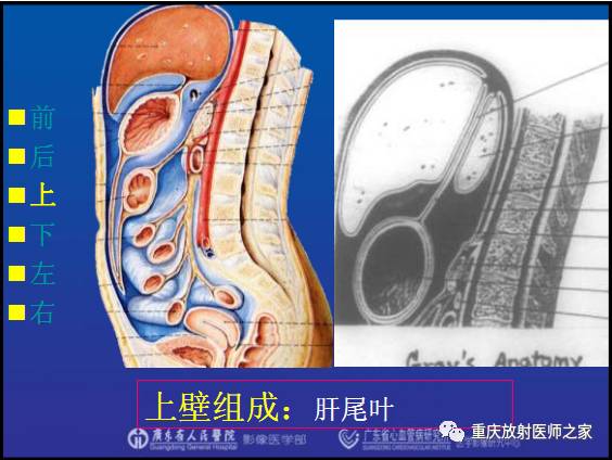影像PPT - 【PPT】网膜囊疝的影像诊断-20