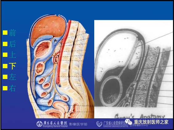 影像PPT - 【PPT】网膜囊疝的影像诊断-22