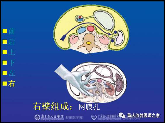 影像PPT - 【PPT】网膜囊疝的影像诊断-28
