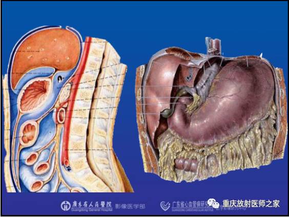 影像PPT - 【PPT】网膜囊疝的影像诊断-29