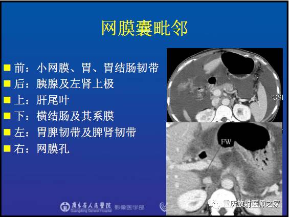影像PPT - 【PPT】网膜囊疝的影像诊断-33