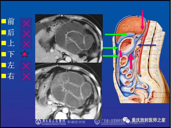影像PPT - 【PPT】网膜囊疝的影像诊断-36