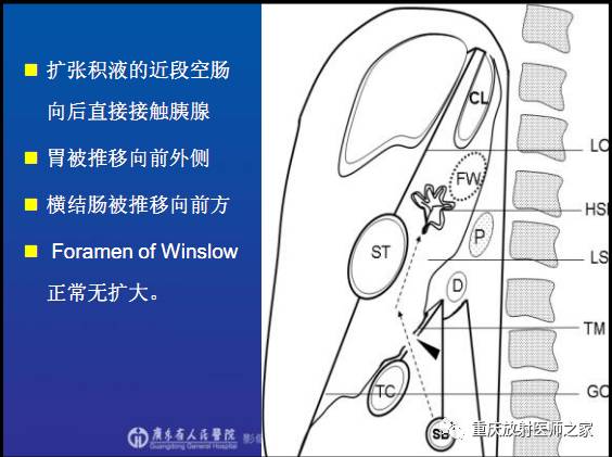影像PPT - 【PPT】网膜囊疝的影像诊断-38