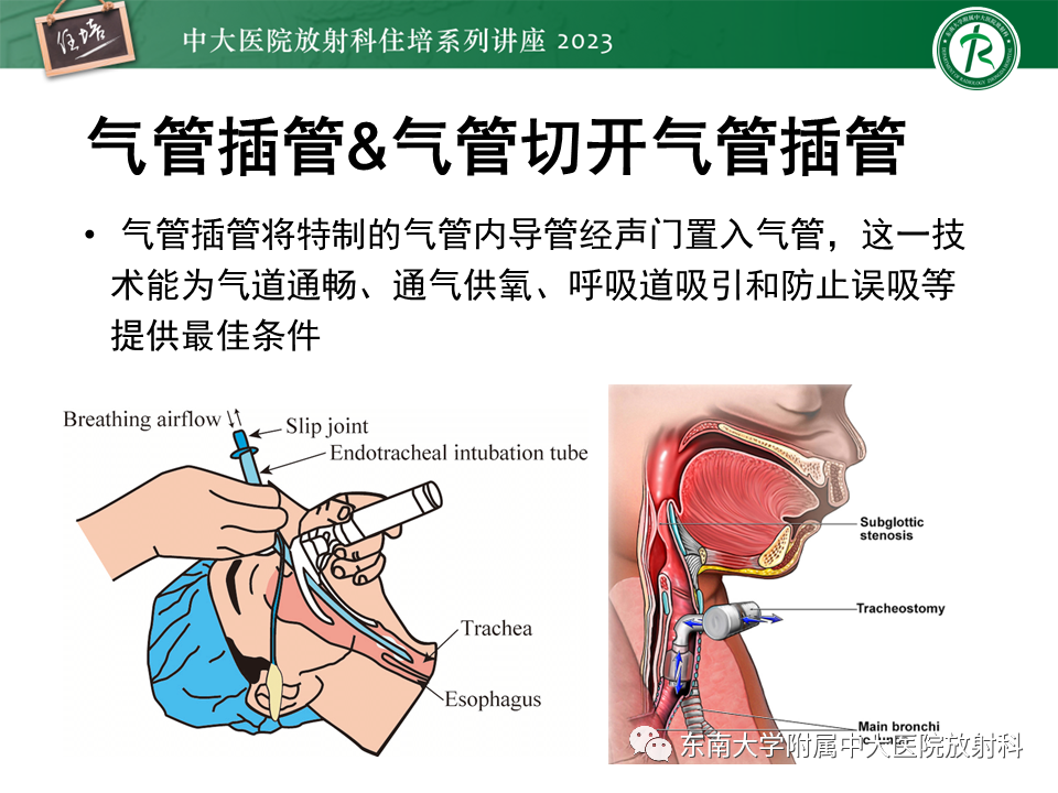 影像PPT - 【PPT】体部常见置管影像解读-6