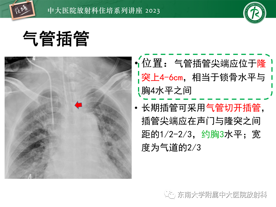 影像PPT - 【PPT】体部常见置管影像解读-8