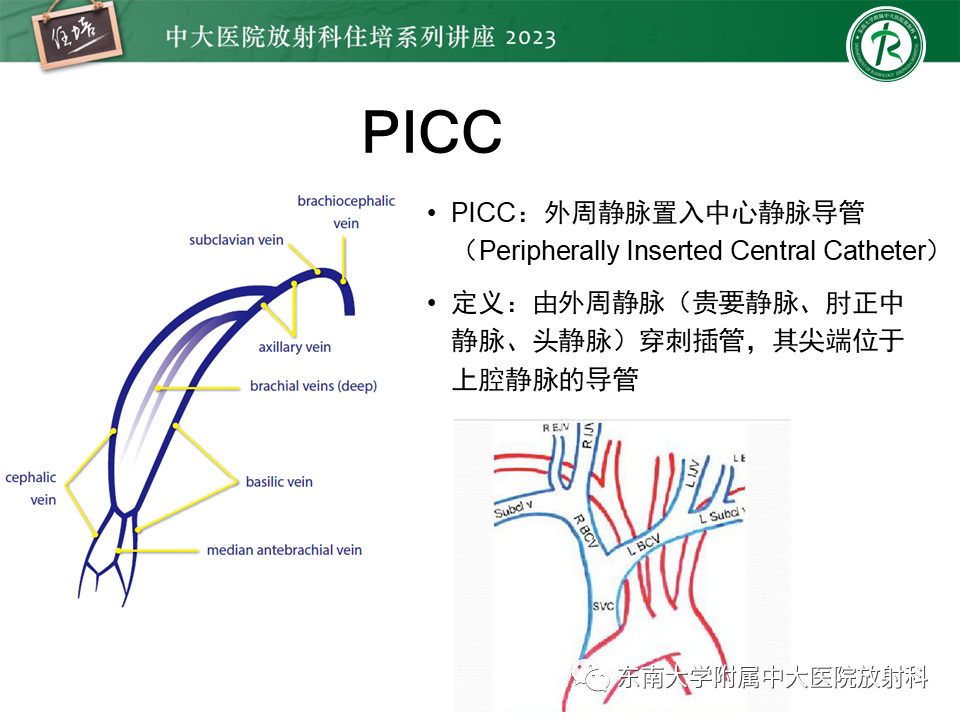 影像PPT - 【PPT】体部常见置管影像解读-12