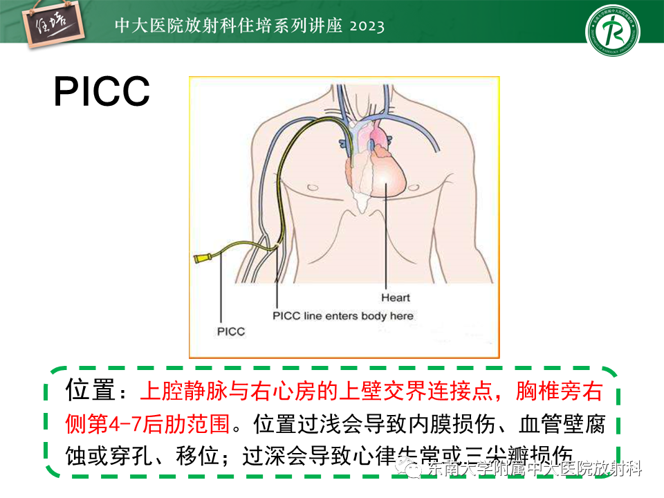影像PPT - 【PPT】体部常见置管影像解读-14