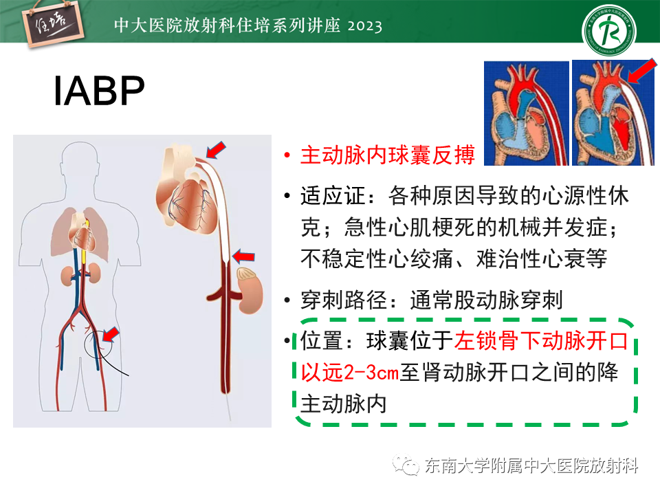 影像PPT - 【PPT】体部常见置管影像解读-42