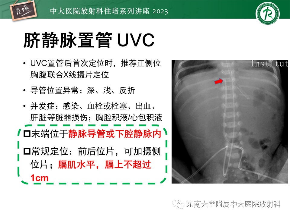 影像PPT - 【PPT】体部常见置管影像解读-51