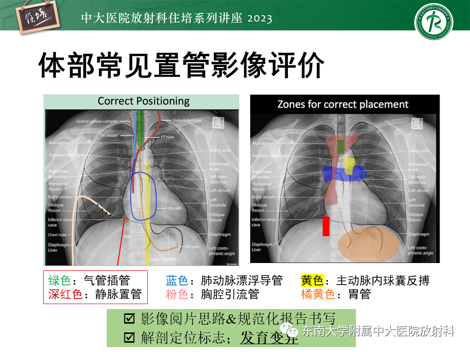 影像PPT - 【PPT】体部常见置管影像解读-61