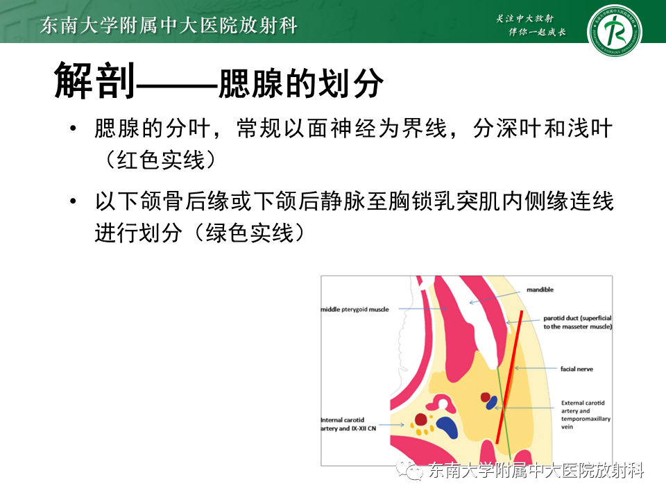 影像PPT - 【PPT】多形性腺瘤-9