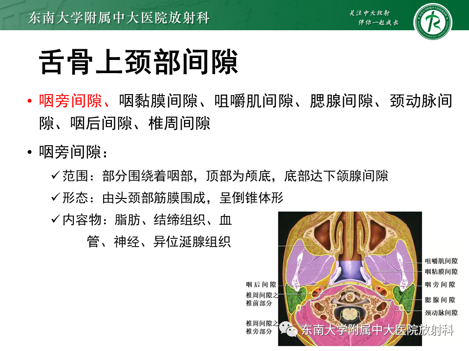 影像PPT - 【PPT】多形性腺瘤-10