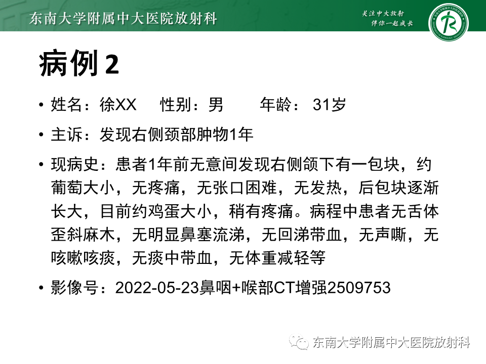 影像PPT - 【PPT】多形性腺瘤-14