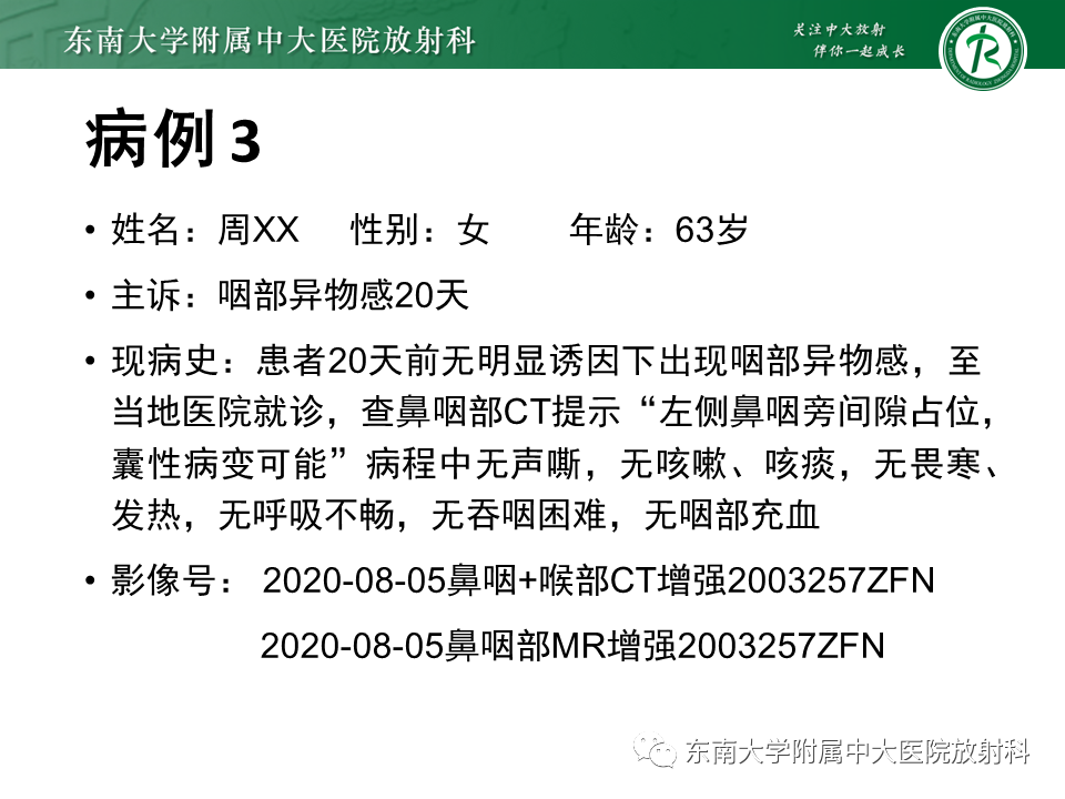 影像PPT - 【PPT】多形性腺瘤-24